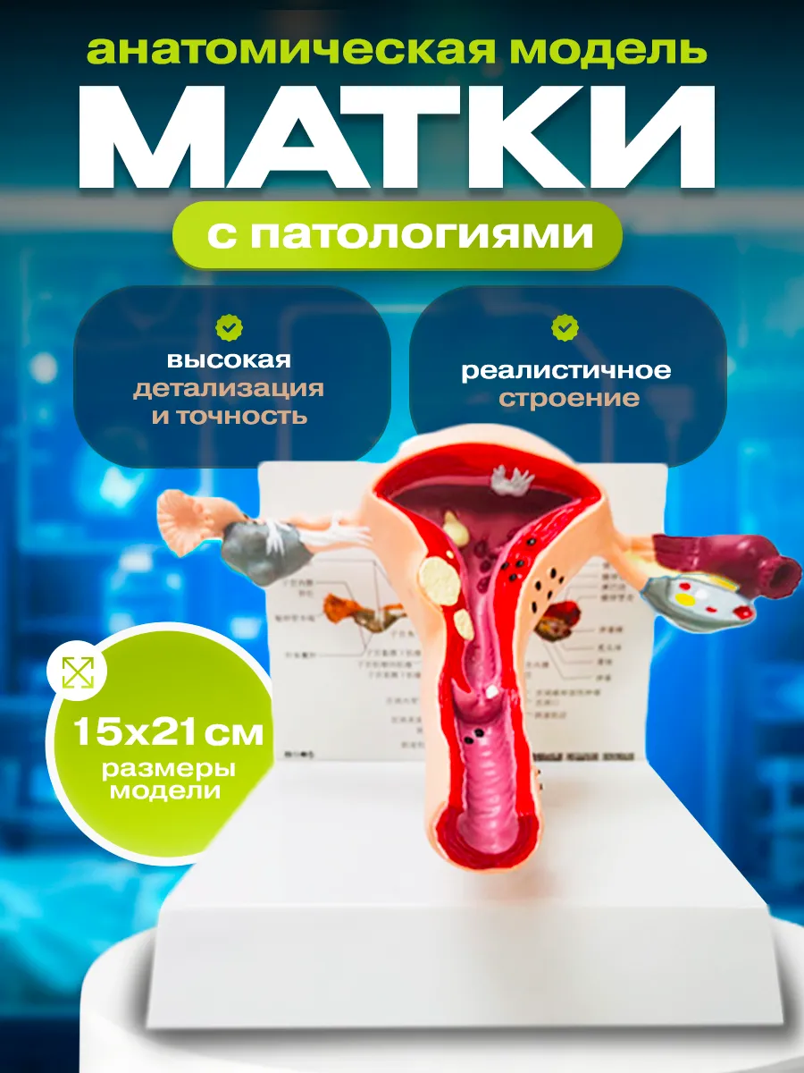 Анатомическая модель матки с патологиями