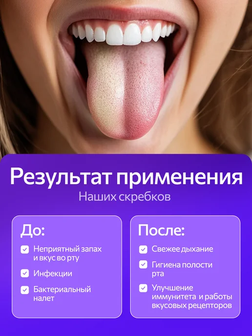 Чистилка щетка для чистки взрослых Скребок для языка от налета и запаха, вариант, фото 4