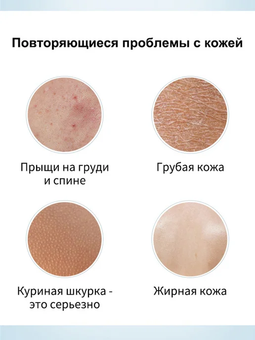 Гель для душа против акне и клещей 300 МЛ, 300 мл, фото 4