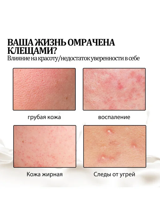eelhoe Очищающее мыло для лица Удалить клещей угревой Глубокое очищ, вариант, фото 5