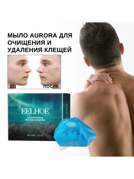 eelhoe Очищающее мыло для лица Удалить клещей угревой Глубокое очищ, вариант, фото 6