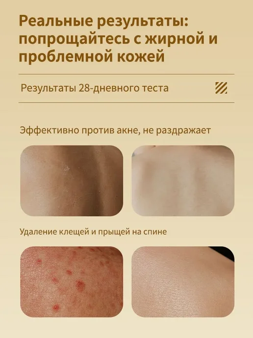Гель для душа Увлажнение и Релакс Против пылевых клещей,500…, 500 мл, фото 3