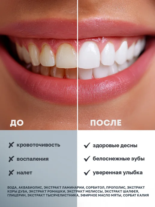 Аквабиолис Ополаскиватель для рта при кровоточивости и воспалении десен, зеленый, фото 4