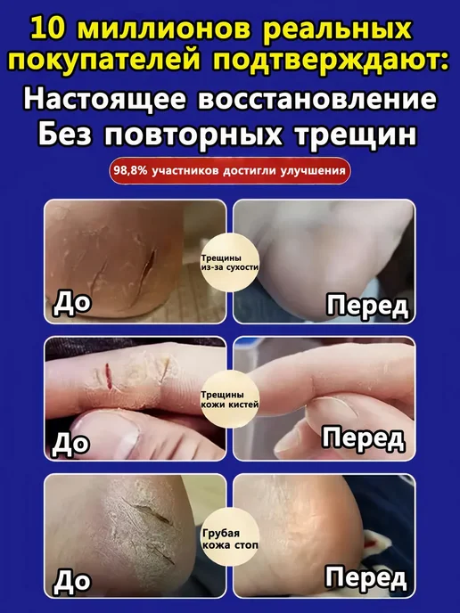 Крем для ног от трещин и сухости, 250 мл, фото 3