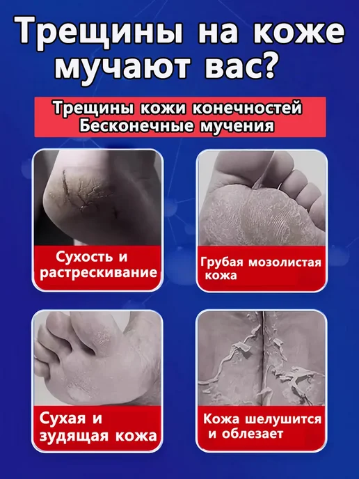 Крем для ног от трещин и сухости, 250 мл, фото 4