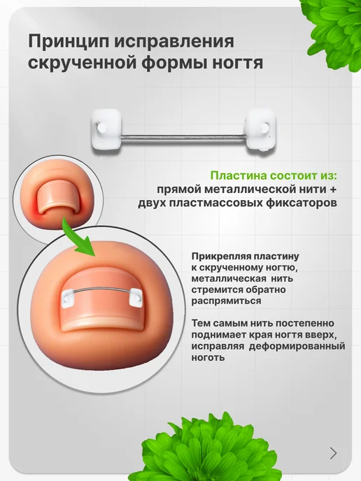 Ровные ноготочки Готовый набор нитей (16-17 мм) для коррекции вросшего ногтя, 16-17, фото 2